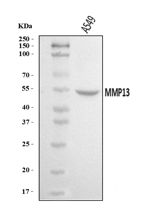  Western blot analysis of MMP13 using anti-MMP13 antibody (A00420-3)