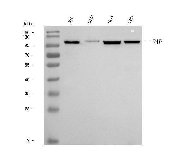  Western blot analysis of Fibroblast activation protein, alpha/FAP using anti-Fibroblast activation protein, alpha/FAP antibody (A00422-5)