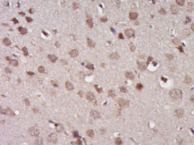 a00424 2 traf3 primary antiboties ihc testing 2