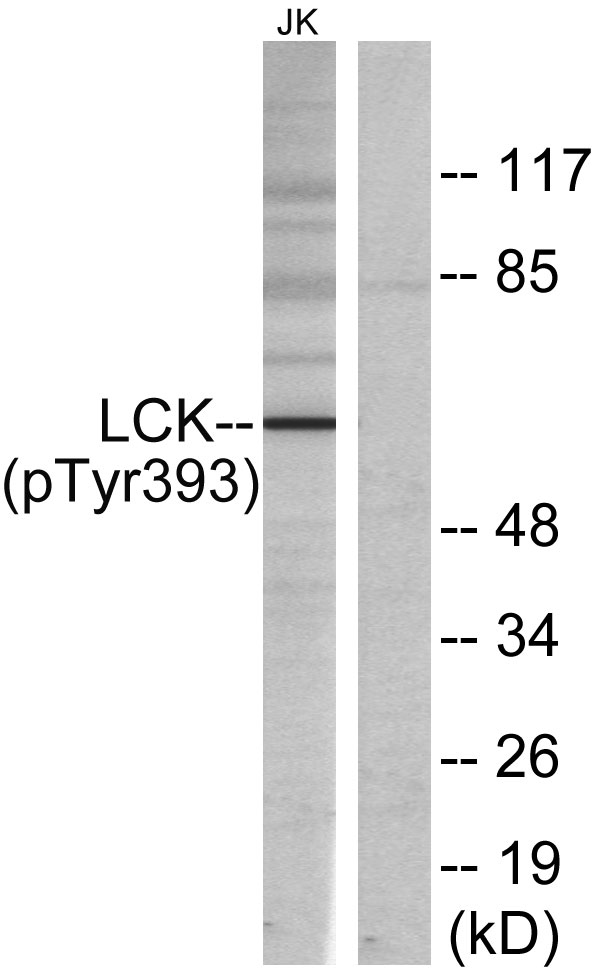 Western blot analysis of lysates from Jurkat cells, using Lck (Phospho-Tyr393) Antibody