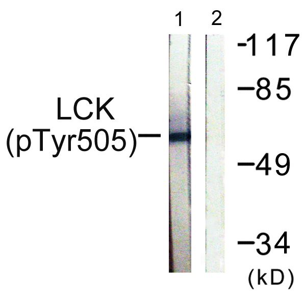 Western blot analysis of lysates from Jurkat cells, using Lck (Phospho-Tyr505) Antibody