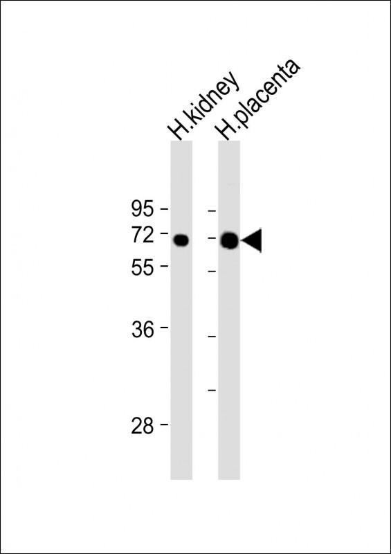 All lanes : Anti-EPOR Antibody (C-term) at 1:2000 dilutionLane 1: H
