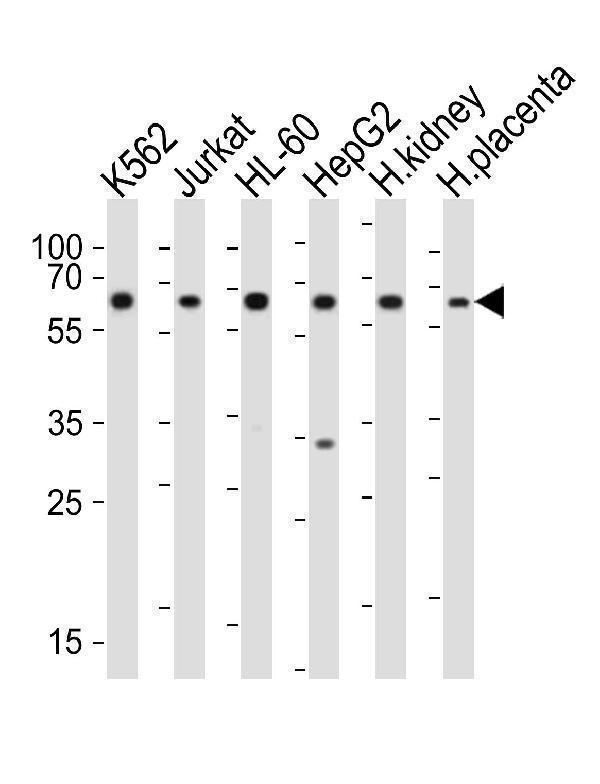 Western blot analysis of lysates from K562, Jurkat, HL-60, HepG2 cell line, human kidney, human placenta tissue(from left to right), using EPOR Antibody (C-term)