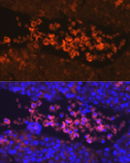 a00427 epor primary antiboties if testing 2