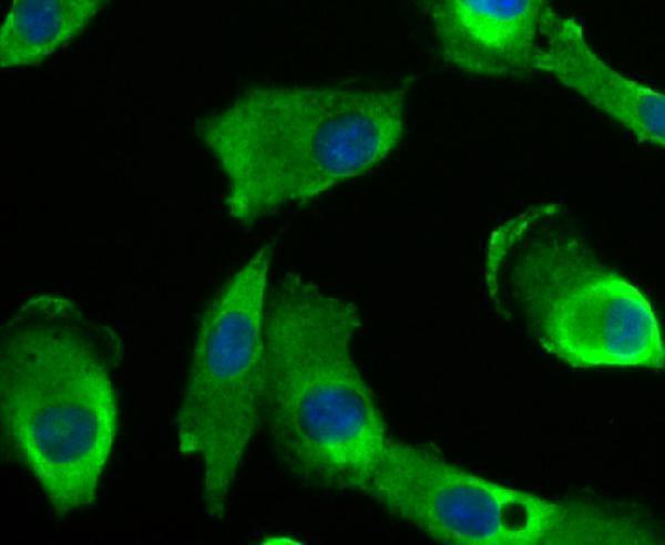 ICC staining Niemann Pick C1 in A549 cells (green)