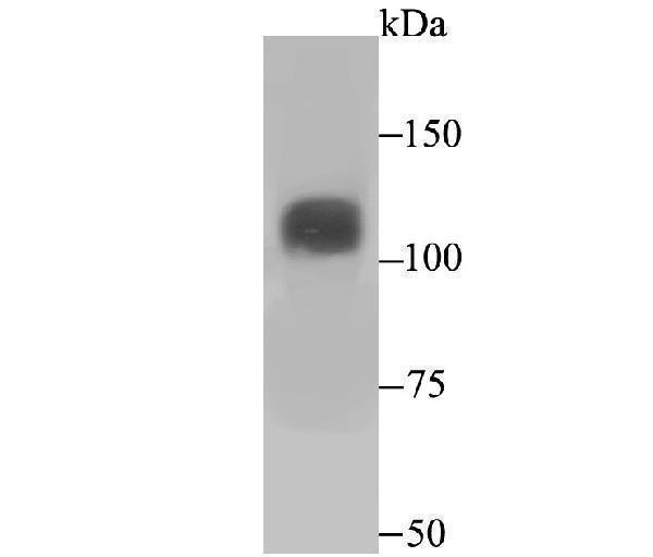 Western blot analysis of Niemann Pick C1 on SiHa cell lysate using anti-Niemann Pick C1 antibody at 1/500 dilution