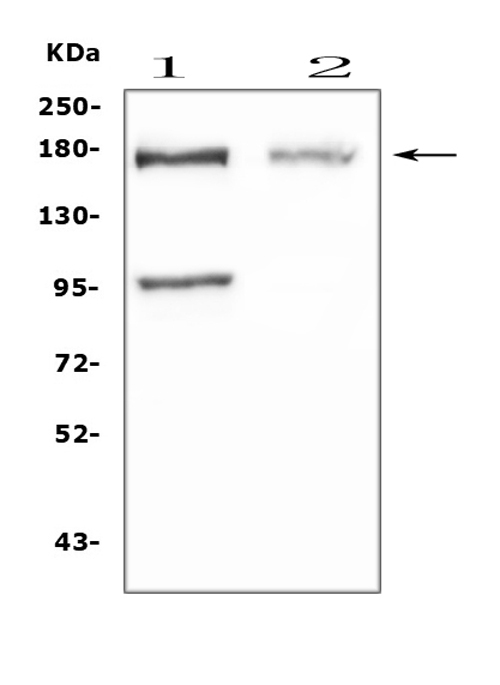 a00428 2 niemann_pick_c1 primary antibodies wb testing 1