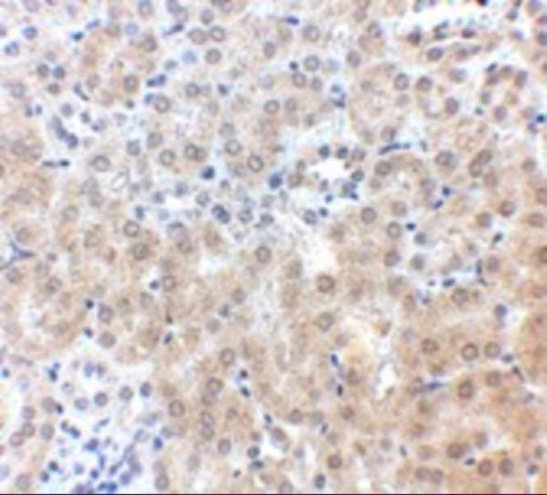 Immunohistochemistry of NPC1 in mouse kidney tissue with NPC1 antibody at 2