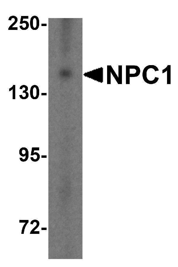 Western blot analysis of NPC1 in HepG2 cell lysate with NPC1 antibody at 1 μg/mL