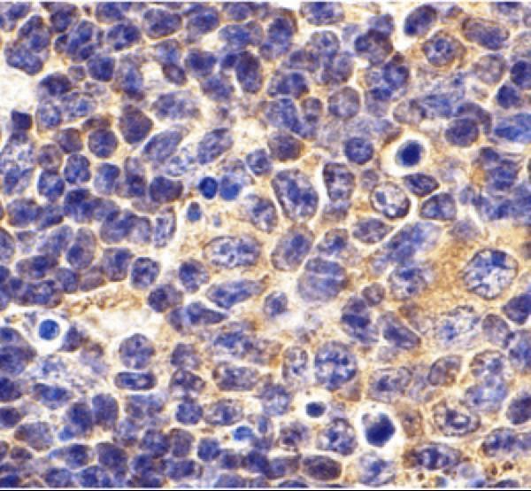 a00429 tlr1 primary antibodies ihc testing 2