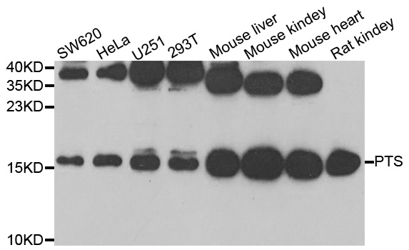 WesternBlot (WB) analysis of PTS polyclonal antibody