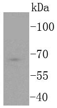 a00431 1 tcf7l2 primary antiboties wb testing 1
