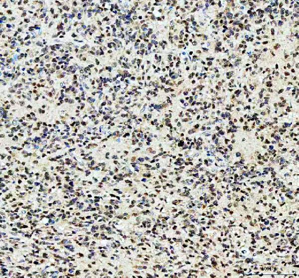 IHC analysis of TCF4/TCF7L2 using anti-TCF4/TCF7L2 antibody (A00431-2)