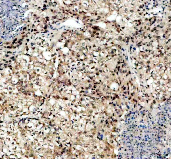 IHC analysis of TCF4/TCF7L2 using anti-TCF4/TCF7L2 antibody (A00431-2)