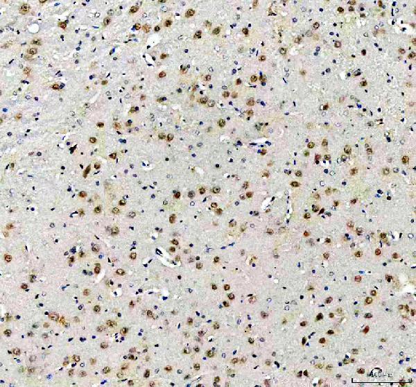 a00431 2 tcf4 primary antibodies ihc testing 3
