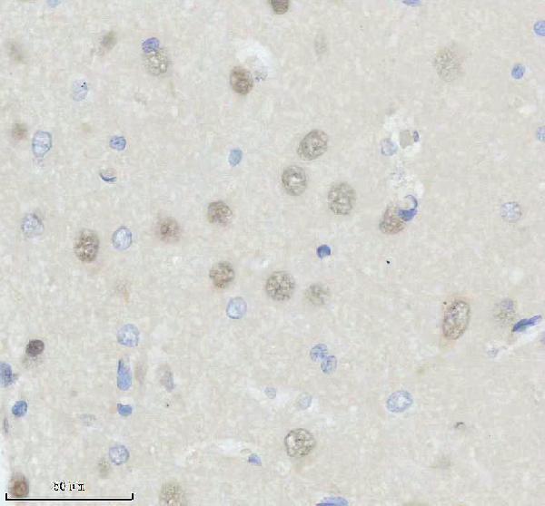 a00431 2 tcf4 primary antibodies ihc testing 4