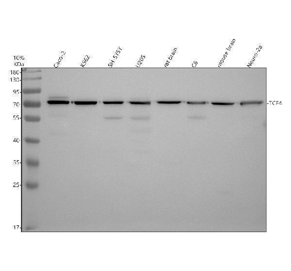 Western blot analysis of TCF4 using anti-TCF4 antibody (A00431-2)