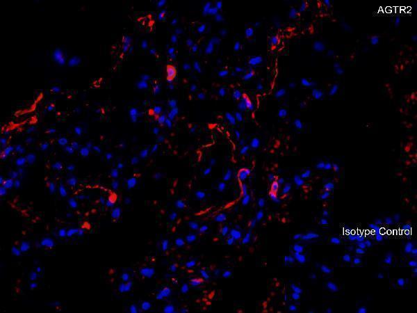 a00432 1 agtr2 primary antibodies if testing 2