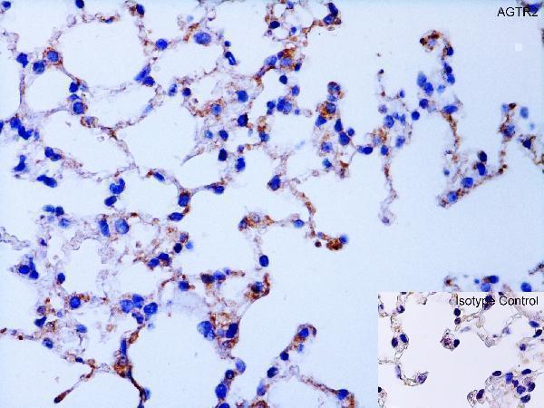 Immunohistochemistry Validation of AGTR2 in Human Lung
Immunohistochemical analysis of paraffin-embedded human lung tissue using anti-AGTR2 antibody (A00432-1) at 1 μg/ml