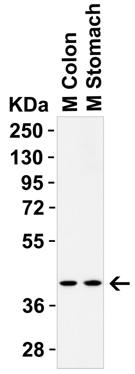 WB Validation in Mouse Tissues
Loading: 10 μg of lysate Antibodies: AGTR2, A00432-1, 2 μ g/mL , 1 h incubation at RT in 5% NFDM/TBST