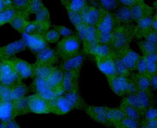 a00433 sirt2 primary antiboties icc testing 1