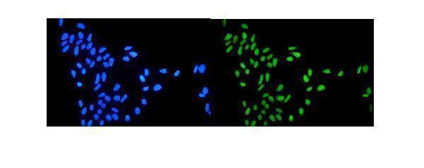 a00434 1 topoisomerase_i primary antibodies if testing 2