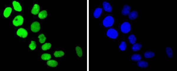 ICC staining TOP1 in Hela cells (green)