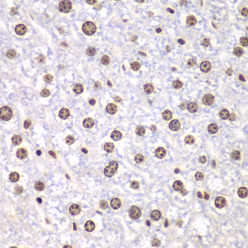 a00434 top1 primary antiboties ihc testing 2