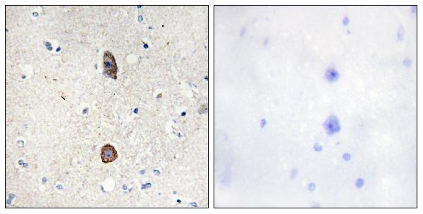 Immunohistochemistry analysis of paraffin-embedded human brain, using IGFBP-3 (Phospho-Ser183) Antibody