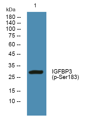 Western blot analysis of lysates from Jurkat cells, primary antibody was diluted at 1:1000, 4°over night