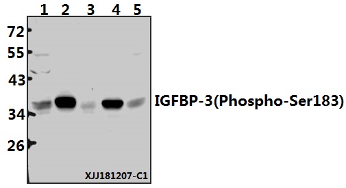 Western blot (WB) analysis of IGFBP-3(Phospho-Ser183) polyclonal antibody at 1:500 dilution
Lane1:HCT116 whole cell lysate(40ug)
Lane2:U-87MG whole cell lysate(40ug)
Lane3:SK-OVCAR3 whole cell lysate(40ug)
Lane4:C6 whole cell lysate(40ug)
Lane5:BV2 whole cell lysate(40ug)