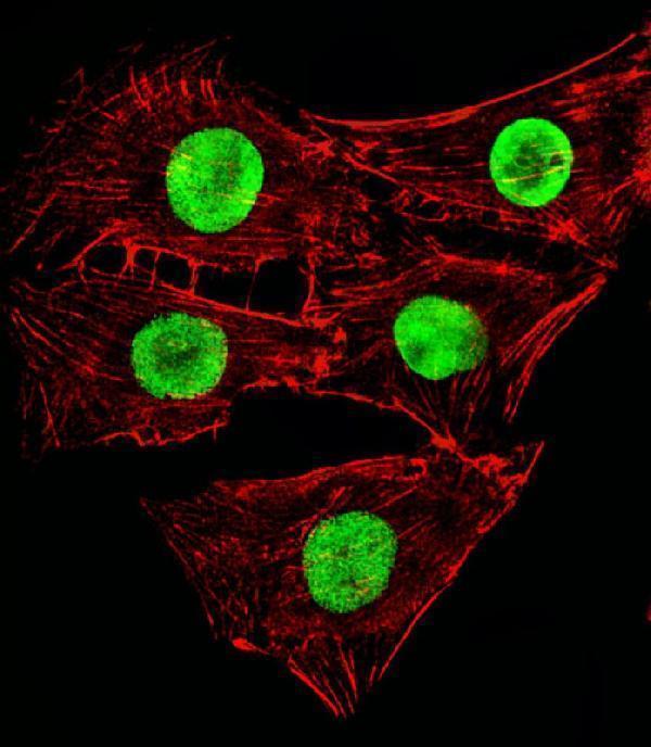 a00436 2 anti mouse hmga2 antibody c term if testing 1