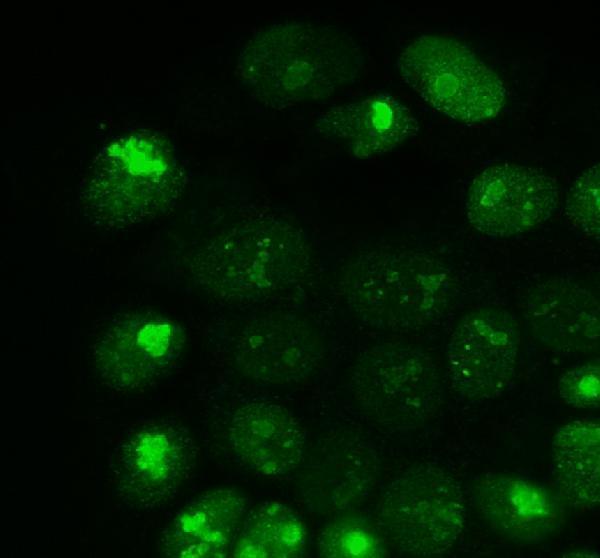  IF analysis of HMGA2 using anti-HMGA2 antibody (A00436-3)