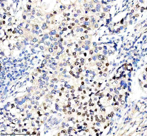  IHC analysis of HMGA2 using anti-HMGA2 antibody (A00436-3)