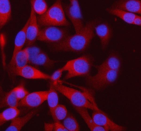 a00437 2 pfkm primary antibodies if testing 12