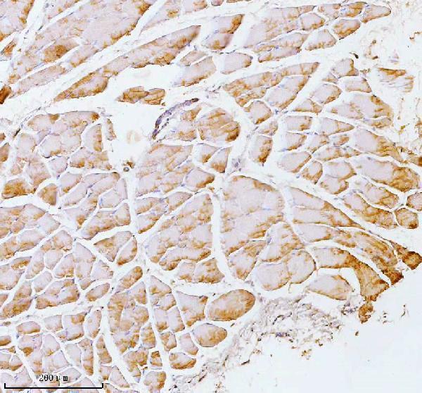a00437 2 pfkm primary antibodies ihc testing 10