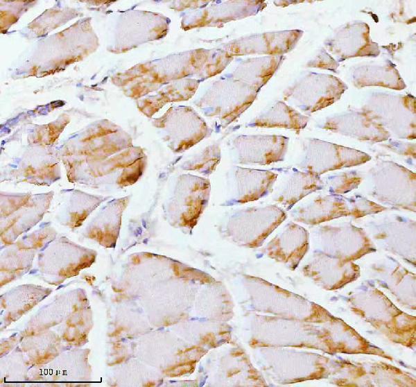 a00437 2 pfkm primary antibodies ihc testing 11