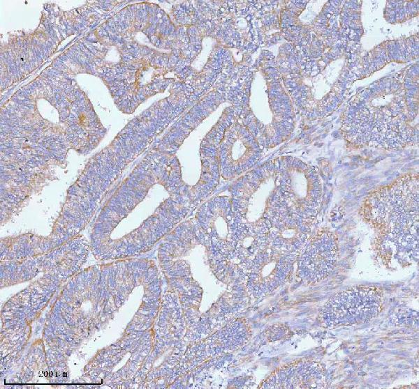  IHC analysis of PFKM using anti-PFKM antibody (A00437-2)