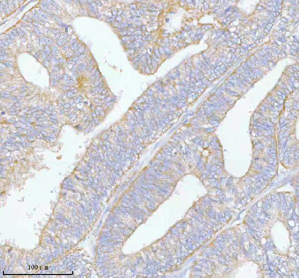  IHC analysis of PFKM using anti-PFKM antibody (A00437-2)