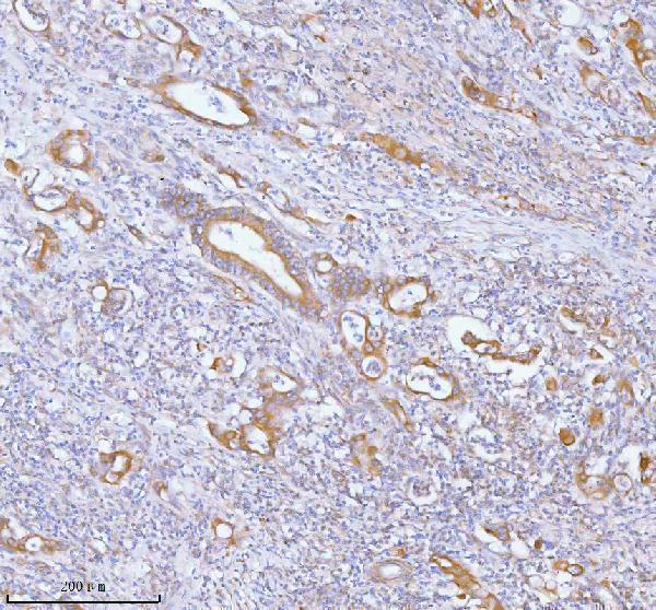 a00437 2 pfkm primary antibodies ihc testing 4