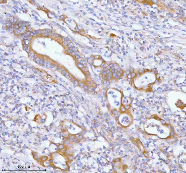 a00437 2 pfkm primary antibodies ihc testing 5