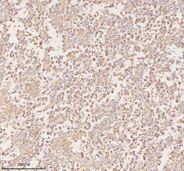 a00437 2 pfkm primary antibodies ihc testing 6
