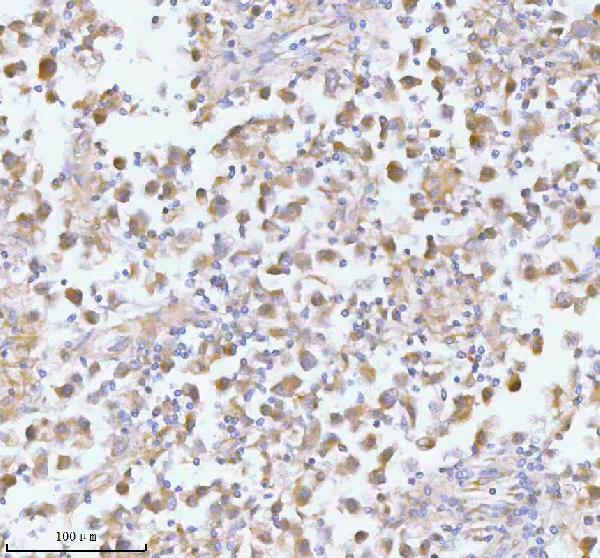 a00437 2 pfkm primary antibodies ihc testing 7