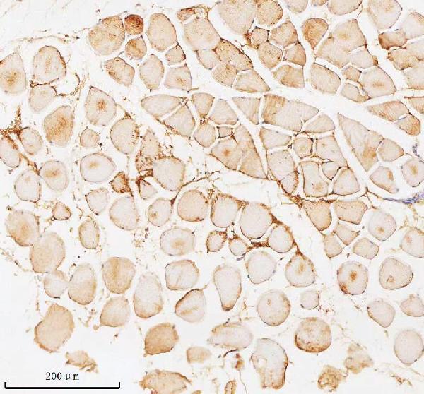 a00437 2 pfkm primary antibodies ihc testing 8