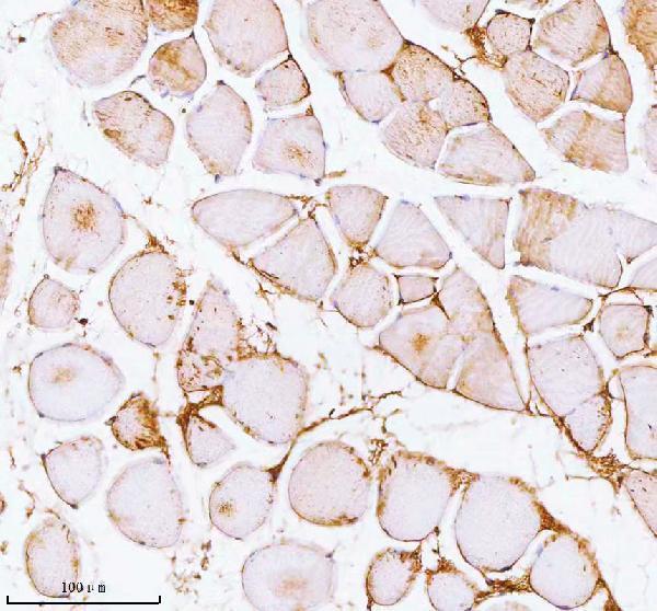 a00437 2 pfkm primary antibodies ihc testing 9
