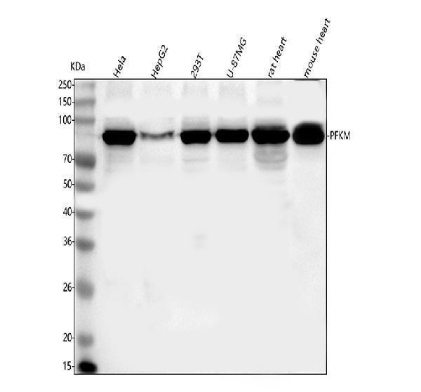 Western blot analysis of PFKM using anti-PFKM antibody (A00437-2)