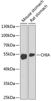Western blot analysis of extracts of various cell lines, using CHIA antibody  at 1:1000 dilution