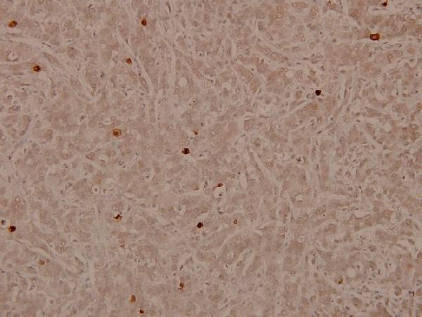 a00438s17 lmna primary antiboties ihc testing 2