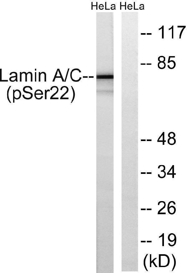 Western blot analysis of lysates from HeLa cells treated with paclitaxel 1uM 24h, using Lamin A (Phospho-Ser22) Antibody