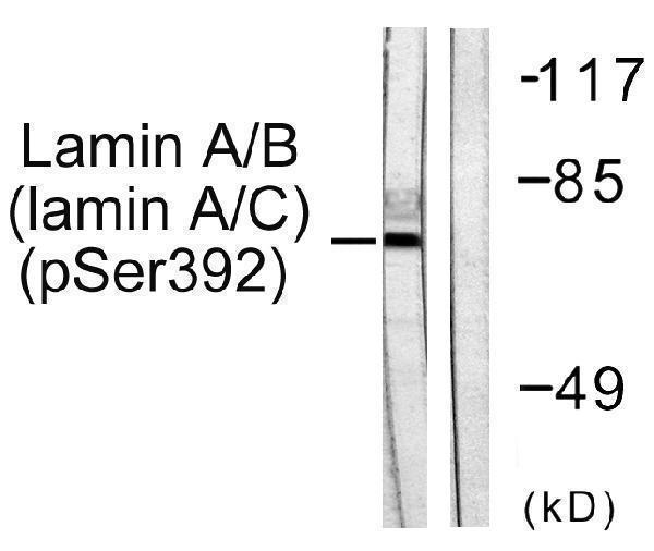 a00438s392 lmna primary antibodies wb testing 2